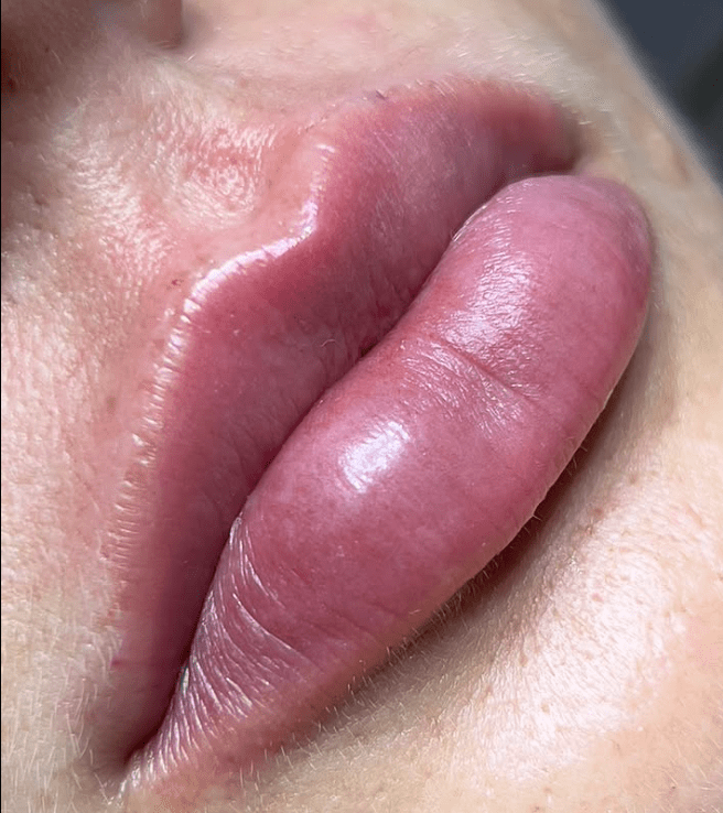 Curso Construindo Lábios - Dra. Thaís Carolinee